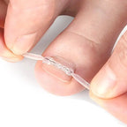 Professional Ingrown Toenail Corrector Tool Pedicure Toe Nail Treatment Embed Straightening Clip Brace for Recovering Foot Care