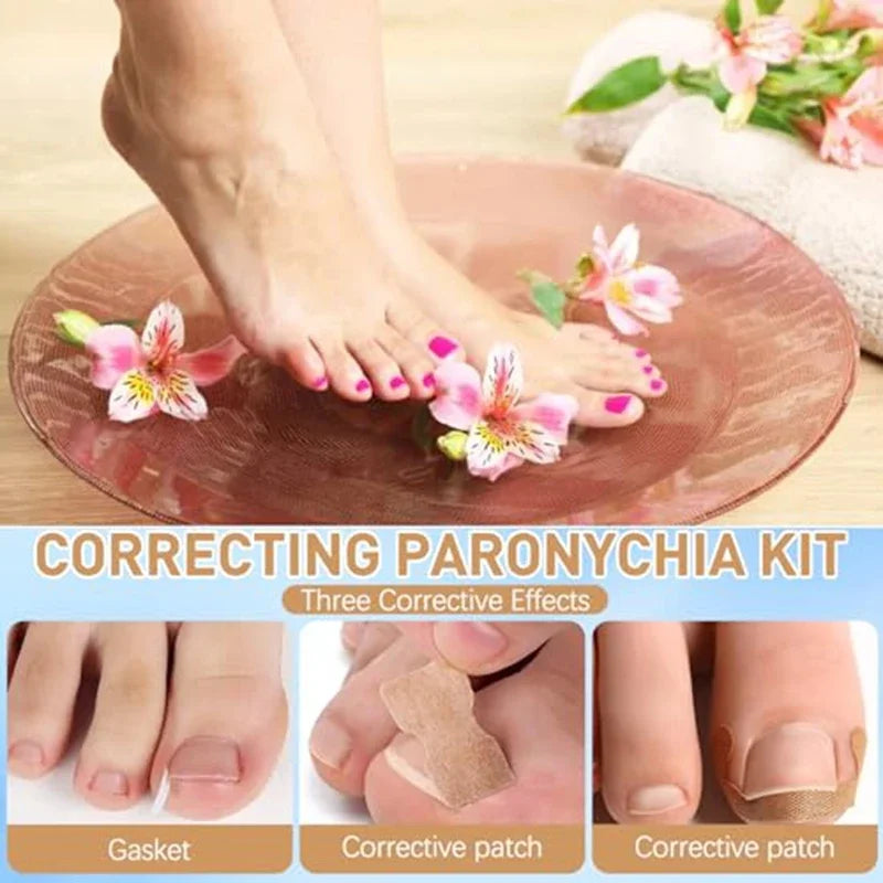Nail Correction Set Ingrown Toenail Correction Patch Stickers Corrector Pedicure Tool Ingrown Toe Nail Treatment Foot Care