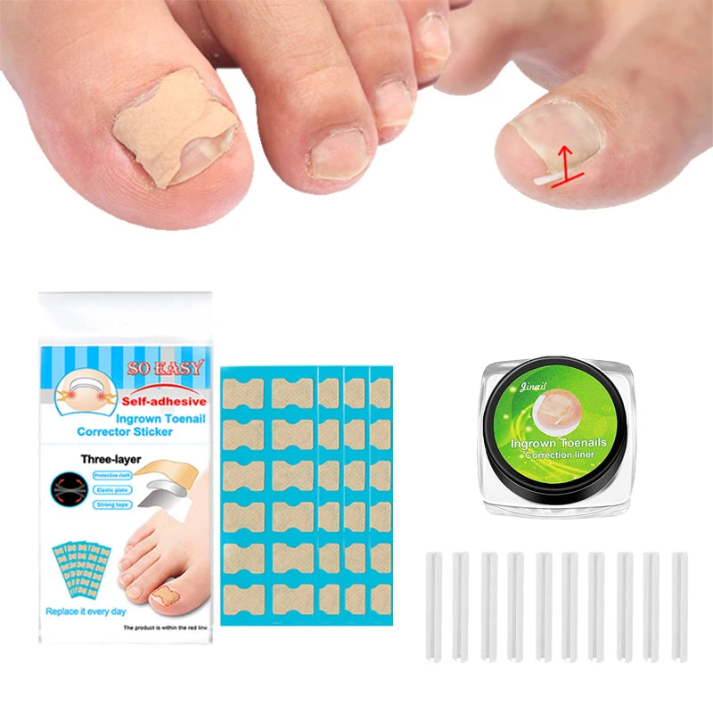 Nails Correction Patches Ingrown Toenail Corrector Toenail Separator Ingrown Correction Tool Ingrown Toenail Correction Patches