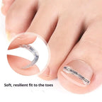 Professional Ingrown Toenail Corrector Tool Pedicure Toe Nail Treatment Embed Straightening Clip Brace for Recovering Foot Care
