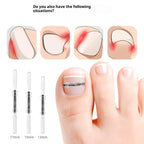 Professional Ingrown Toenail Corrector Tool Pedicure Toe Nail Treatment Embed Straightening Clip Brace for Recovering Foot Care