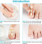 Correction of Paronychia with Toe Nail Correction Bracket for Treatment of Toe and Toe Care with Toe Fixator