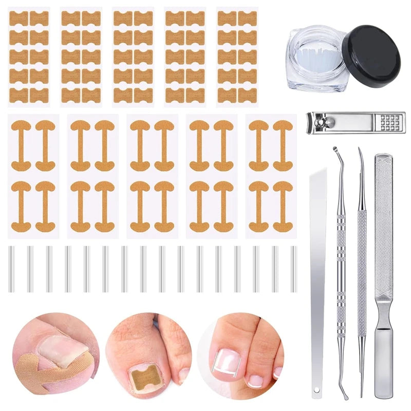 Nail Correction Set Ingrown Toenail Correction Patch Stickers Corrector Pedicure Tool Ingrown Toe Nail Treatment Foot Care