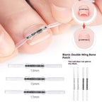 Professional Ingrown Toenail Corrector Tool Pedicure Toe Nail Treatment Embed Straightening Clip Brace for Recovering Foot Care