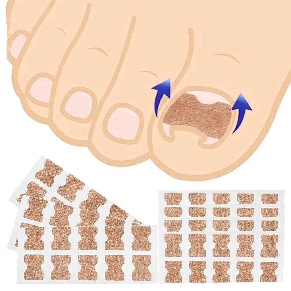 Ingrown Toenail Corrector Straightening Clip Pedicure Foot Nail Care Tools Stainless Steel Pedicure Treatment Onyxis Correction
