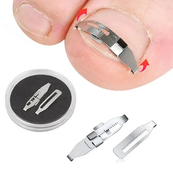 1PC Ingrown Toenail Corrector Tools Pedicure Recover Embed Toe Nail Treatment Professional Ingrown Toenail Correction Foot Care