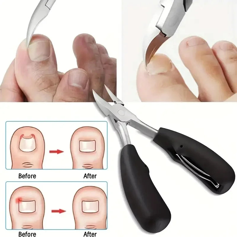 Nail Clippers Professional Hawkbill with Nail Pick Trimmer for Ingrown Toenails Paronychia Cutter for Unisex Home Foot Care Tool