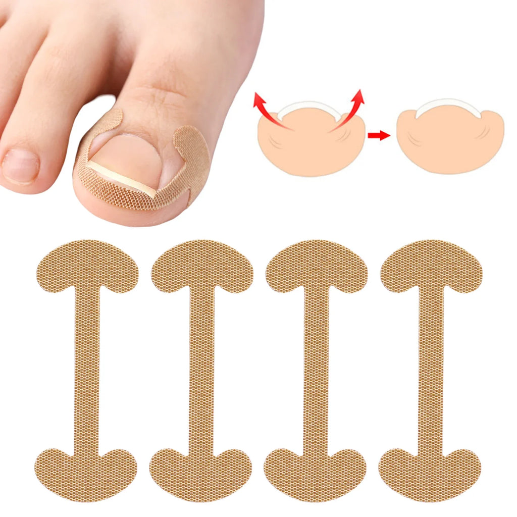 20/40/60pcs Waterproof Nail Correction Stickers Ingrown Toenail Corrector Patches Treatment Recover Corrector Pedicure Care Tool