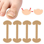 20/40/60pcs Waterproof Nail Correction Stickers Ingrown Toenail Corrector Patches Treatment Recover Corrector Pedicure Care Tool