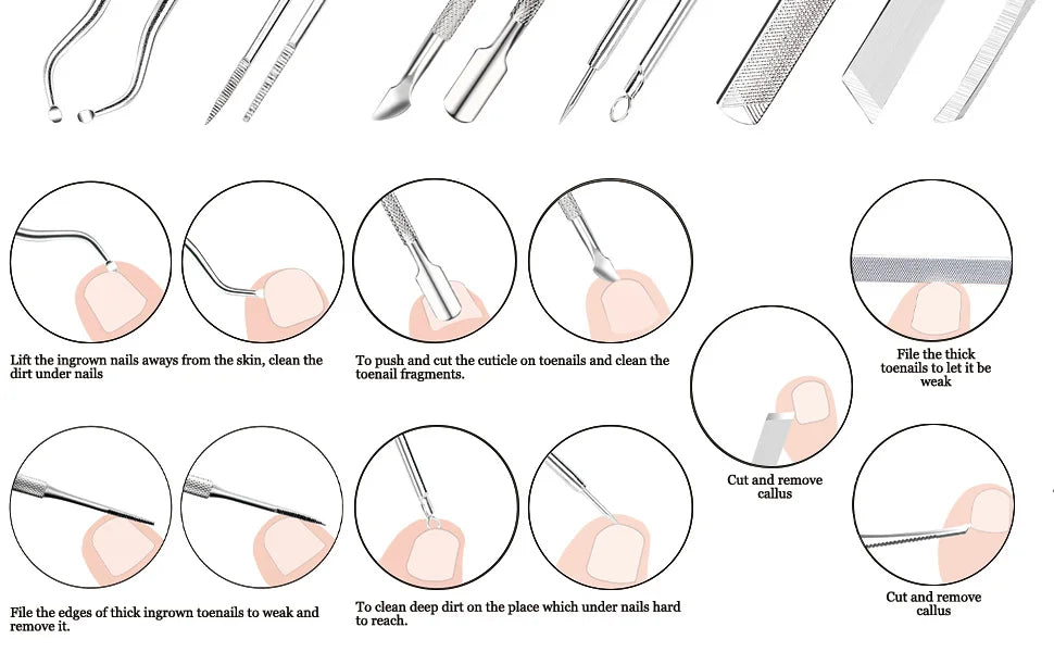 7 Pcs Ingrown Toenail File and Lifters Set, Stainless Steel Ingrown Toenail Removal Kit, Under Nail Cleaner Pedicure Tools