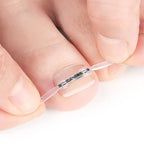 Professional Ingrown Toenail Corrector Tool Pedicure Toe Nail Treatment Embed Straightening Clip Brace for Recovering Foot Care