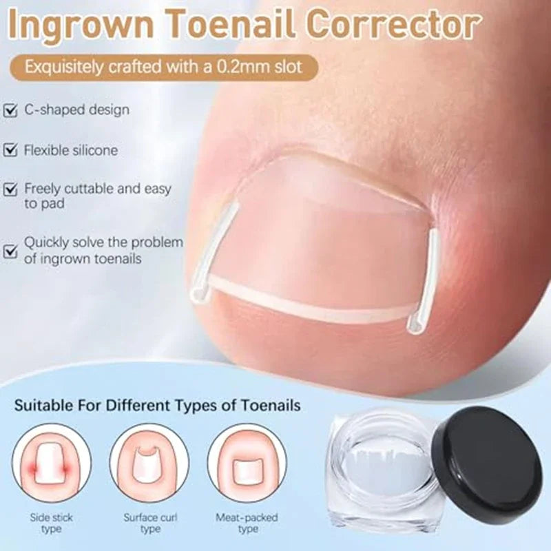 Nail Correction Set Ingrown Toenail Correction Patch Stickers Corrector Pedicure Tool Ingrown Toe Nail Treatment Foot Care