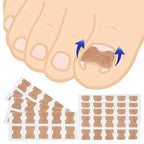 Nail Correction Set Ingrown Toenail Correction Patch Stickers Corrector Pedicure Tool Ingrown Toe Nail Treatment Foot Care