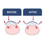 Ingrown Toenail Corrector Pedicure Recover Embed Toe Nail Treatment Professional Foot Correction Patch Stickers Care Tool