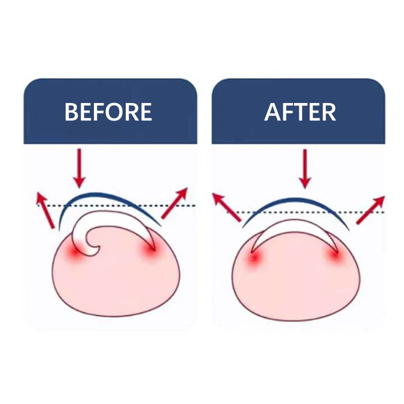 Ingrown Toenail Corrector Pedicure Recover Embed Toe Nail Treatment Professional Foot Correction Patch Stickers Care Tool