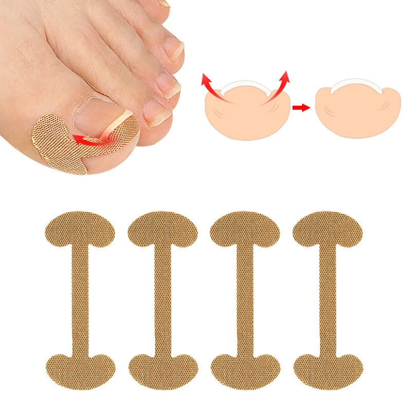 4Pcs/8Pcs/12Pcs Nail Correction Stickers Ingrown Toenail Corrector Patches Treatment Recover Corrector Foot Pedicure Care Tool