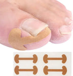 20/40/60pcs Waterproof Nail Correction Stickers Ingrown Toenail Corrector Patches Treatment Recover Corrector Pedicure Care Tool
