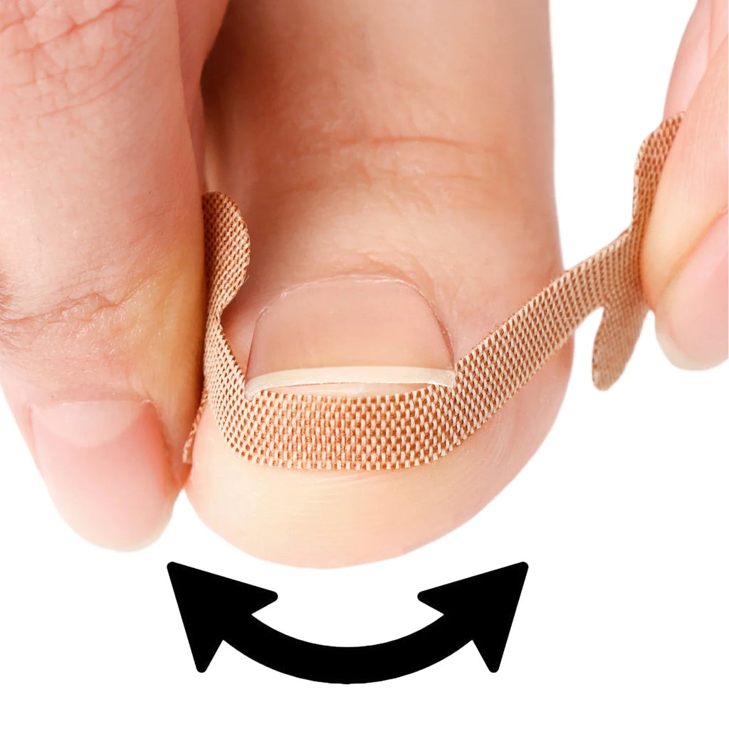 20/40/60pcs Waterproof Nail Correction Stickers Ingrown Toenail Corrector Patches Treatment Recover Corrector Pedicure Care Tool