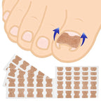 Ingrown Toenail Corrector Straightening Clip Pedicure Foot Nail Care Tools Stainless Steel Pedicure Treatment Onyxis Correction