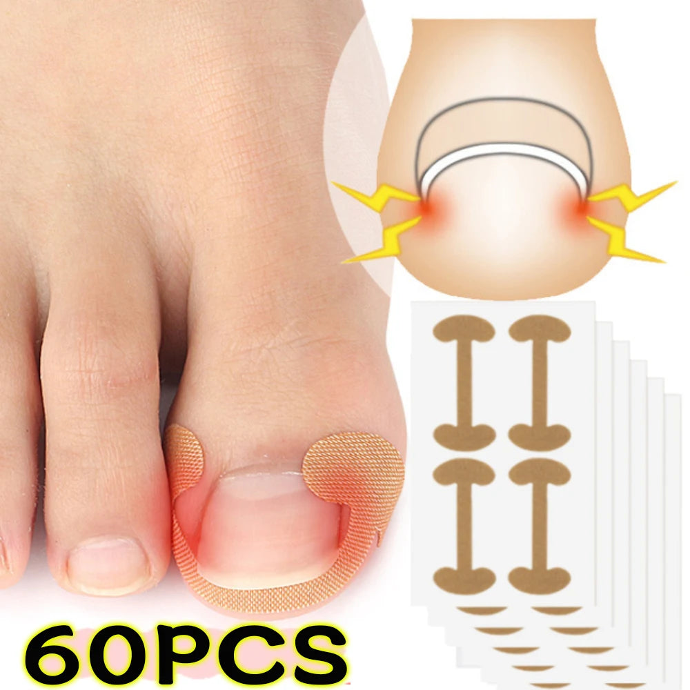 20/40/60pcs Waterproof Nail Correction Stickers Ingrown Toenail Corrector Patches Treatment Recover Corrector Pedicure Care Tool