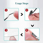 Nail Clippers Ingrown Toenail Podiatry Correction Nippers Cuticle Cutters Cut Paronychia Pedicure Manicure Hand Foot Care Tool