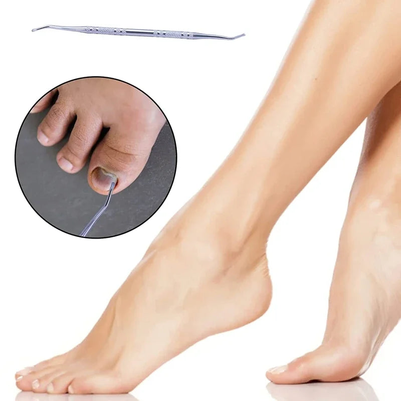 Nail Correction Set Ingrown Toenail Correction Patch Stickers Corrector Pedicure Tool Ingrown Toe Nail Treatment Foot Care