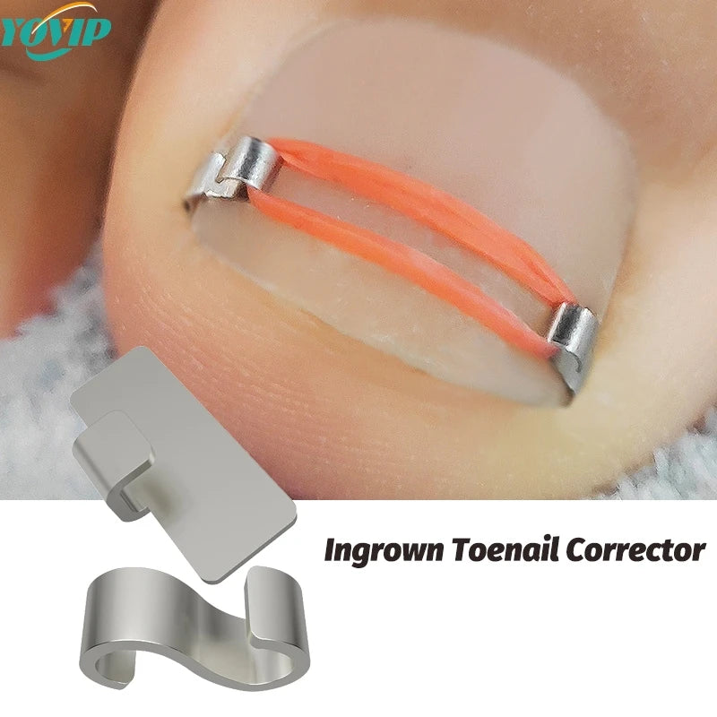 Ingrown Toenail Corrector Pedicure Recover Embed Toe Nail Treatment Professional Foot Correction Patch Stickers Care Tool