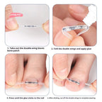 Professional Ingrown Toenail Corrector Tool Pedicure Toe Nail Treatment Embed Straightening Clip Brace for Recovering Foot Care