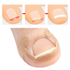 20/40/60pcs Waterproof Nail Correction Stickers Ingrown Toenail Corrector Patches Treatment Recover Corrector Pedicure Care Tool